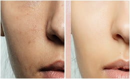 Before and after — dull skin