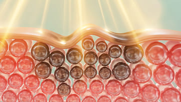 Pigment cells stuck in overproduction